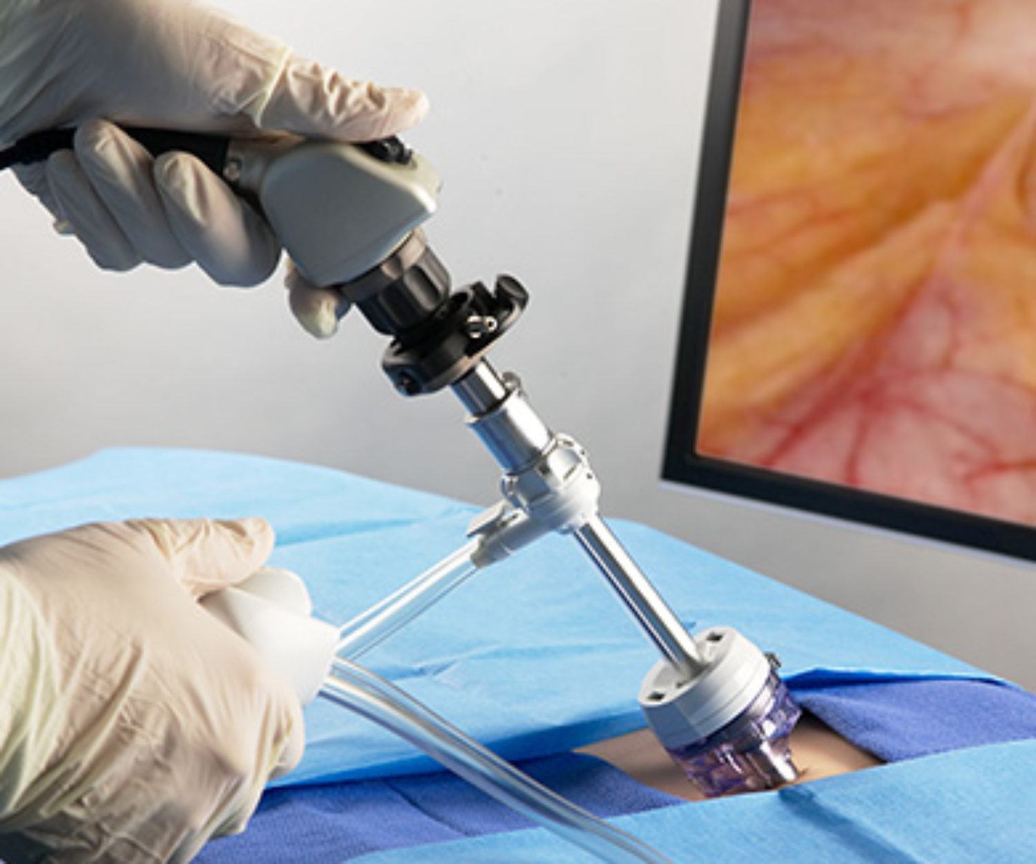 priority_designs_medical_laparoscopic_product_design_and_engineering_004